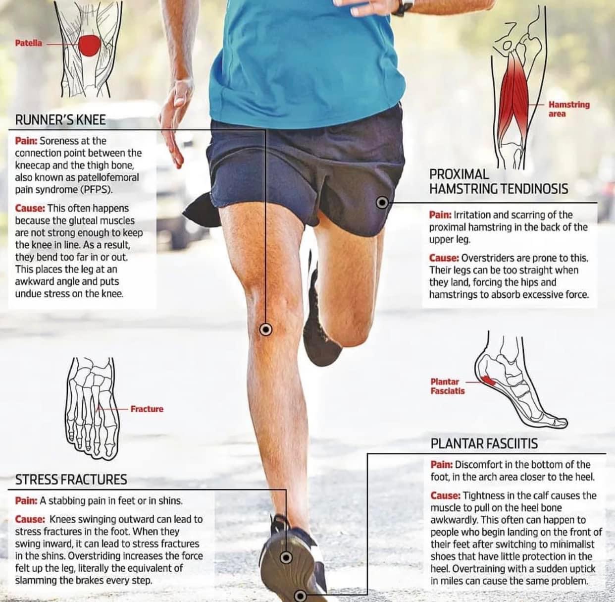 Kecederaan dalam Larian